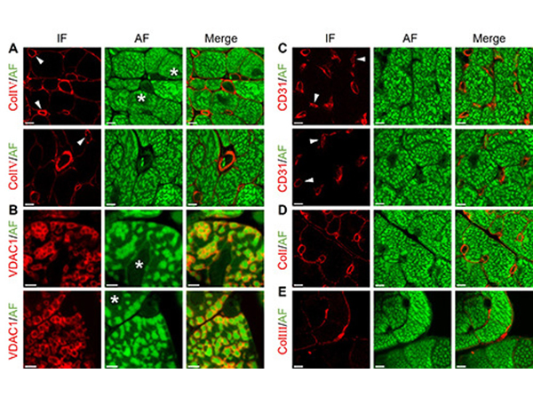 Immunofluorescence using Collagen Type III