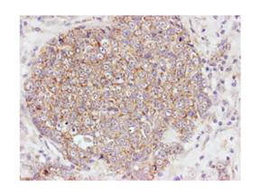 Anti-AKT pS473 Antibody - Immunohistochemistry