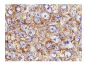 Anti-AKT pS473 Antibody - Immunohistochemistry