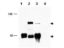 Anti-MECT1 Antibody - Western Blot