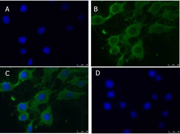 PINK1 truncated Antibody