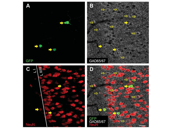 Immunofluorescence using Goat Anti-Mouse IgG DyLight™405