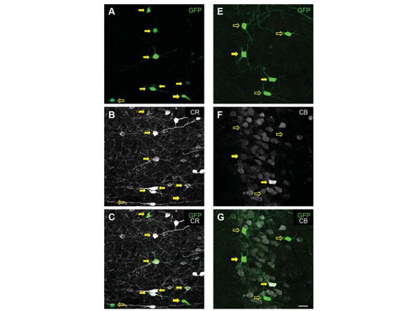 Immunofluorescence using Goat Anti-Mouse IgG DyLight™405
