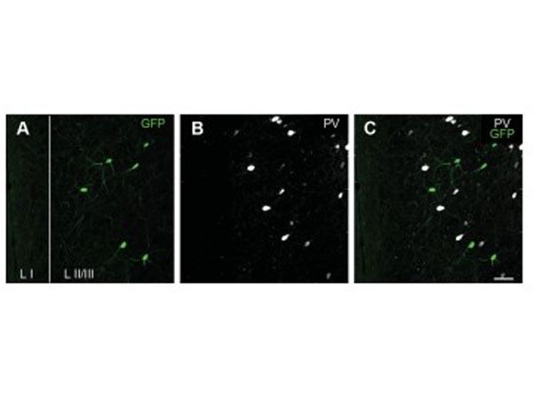 Immunofluorescence using Goat Anti-Mouse IgG DyLight™405
