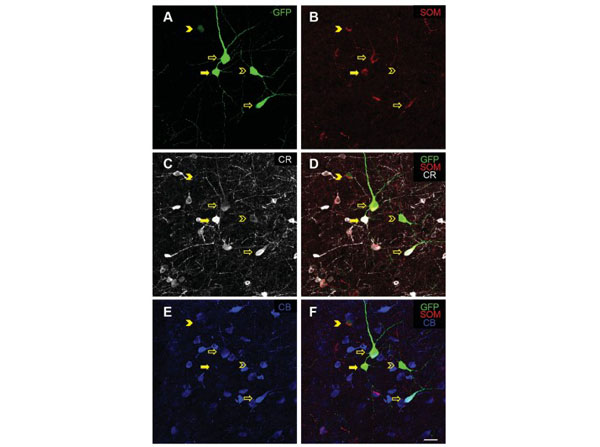 Immunofluorescence using Goat Anti-Mouse IgG DyLight™405