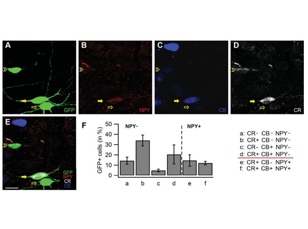 Immunofluorescence using Goat Anti-Mouse IgG DyLight™405
