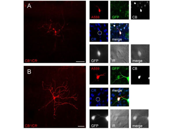 Immunofluorescence using Goat Anti-Mouse IgG DyLight™405