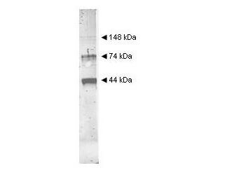 Alcohol Dehydrogenase Antibody