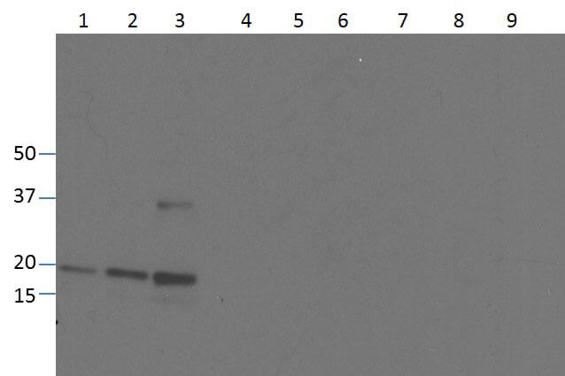 TNF alpha Antibody