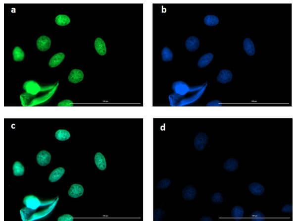 Fluorescent TrueBlot®: Anti-Rabbit IgG Fluorescein