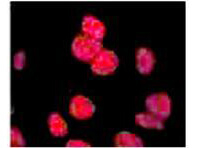 ATM phospho S1981 Biotin Conjugated Antibody