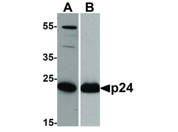 Western Blot of HIV-1 p24 Antibody
