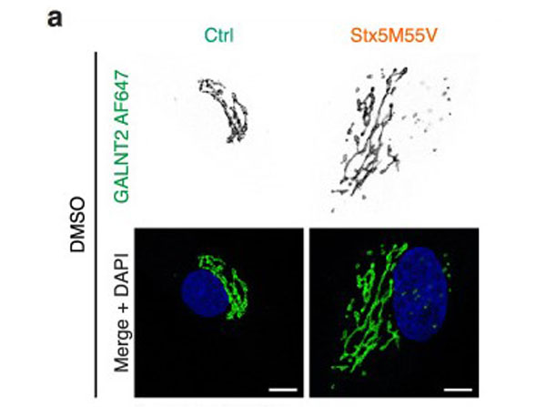 Immunofluorescence using Donkey Serum