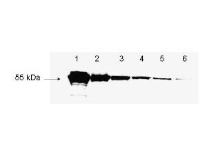 Bovine/Calf Plasma Sterile In Potassium EDTA
