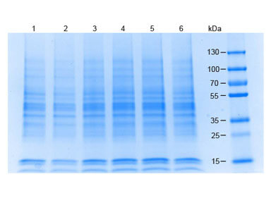 MCF-7 Whole Cell Lysate