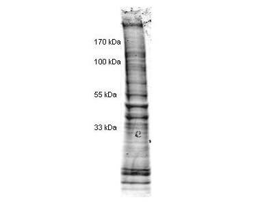 HeLa Cell Nuclear Extract Etoposide Stimulated
