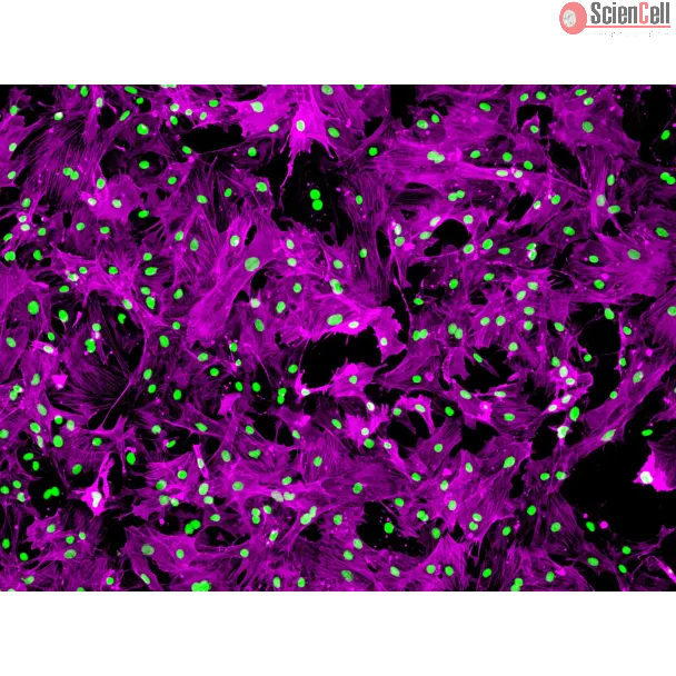 Rat Renal Mesangial Cells (RRMC) - Immunostaining for α-SMA, 100x. 