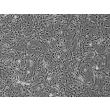 Human Astrocytes (HA) - Phase contrast, 100x. 