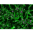 Human Astrocytes (HA) - Immunostaining for GFAP, 200x. 