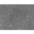 Rat Renal Mesangial Cells (RRMC) - Phase contrast, 100x. 