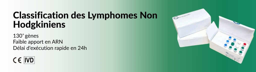 LymphoSign®: Classify Over 80 Subtypes of Non-Hodgkin Lymphoma
