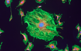 Sonde FGFR1 pour l'HIS CE/IVD - Leucémie myéloïde aiguë (AML)