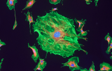 Sonde CDKN2A pour l'HIS CE/IVD - Pathologies uro-génitales