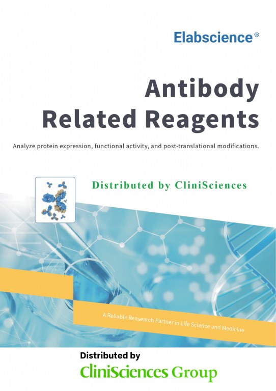 /upload/antibody-related-reagents-32gm4a.jpg