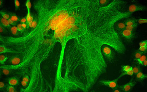 CPN-Streambio-nanoparticles