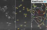  Analyse d'image FastTrack AI de chimiotaxie