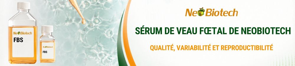 /upload/fbs-nb-fr-tdgv6u.jpg