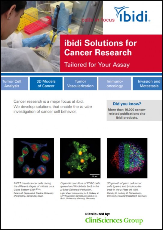 ibidi Solutions for Cancer Research
