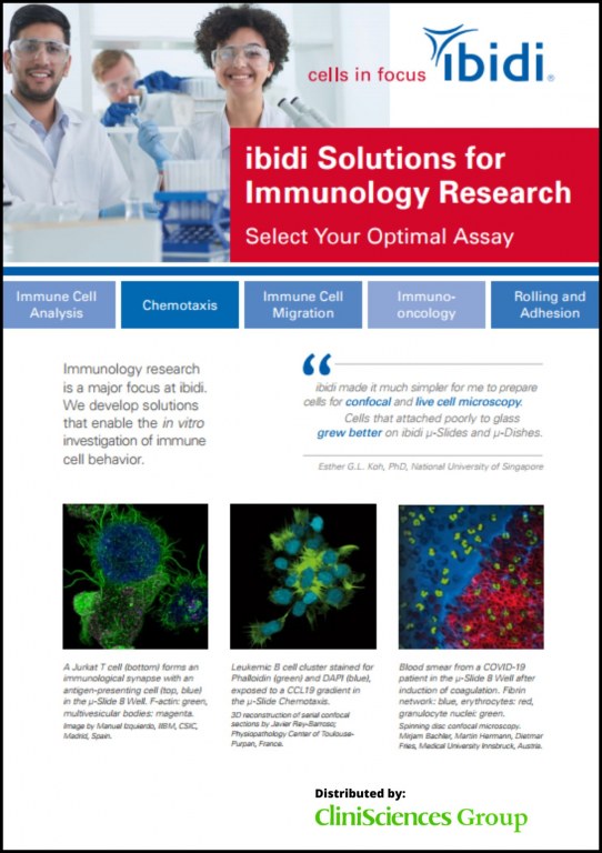 ibidi Solutions for Immunology Research