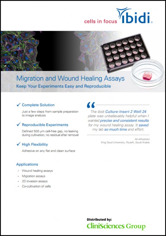 Migration and Wound Healing Assays