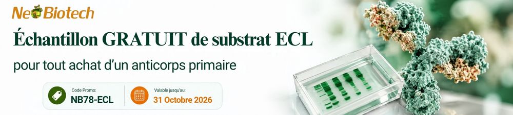 /upload/nb78-promo-fr-f88y2z.jpg