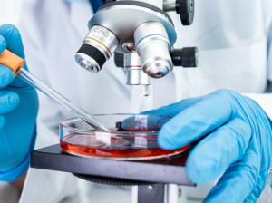 Accédez à des échantillons biologiques humains pour votre recherche en oncologie !