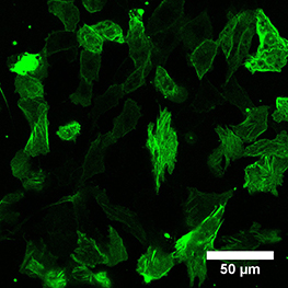 LifeAct-TagGFP2-CHO-K1-2