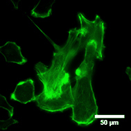 LifeAct-TagGFP2-HT1080