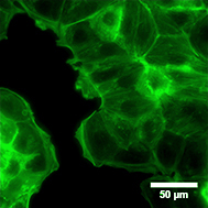 LifeAct-TagGFP2-MCF7
