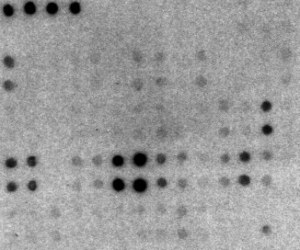 Service à façon : Micro-arrays qualitatifs anti-cytokines