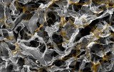 A base d'acide hyaluronique