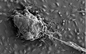 Société Française de la Biologie de la Matrice Extracellulaire (SFBMEc)