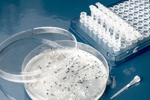 Modifications génétiques de souche bactérienne