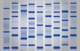 Substrats pour le Western Blot