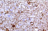 Anti-GFAP CE/IVD pour IHC - Neuropathologie