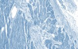 Immunohistochimie classique (IHC)