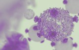Syndromes myelodisplasiques (SMD)