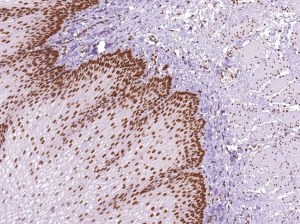 Nouveaux anticorps pour le diagnostic = échantillons gratuits