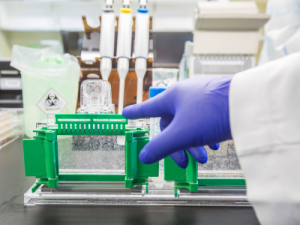 Western blot protocole