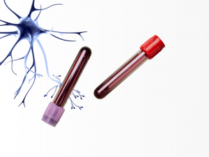 Échantillons d'origine humaine pour les recherches neurologiques